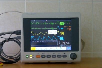 В больницу №1 Петропавловска поступили новые кардиомониторы