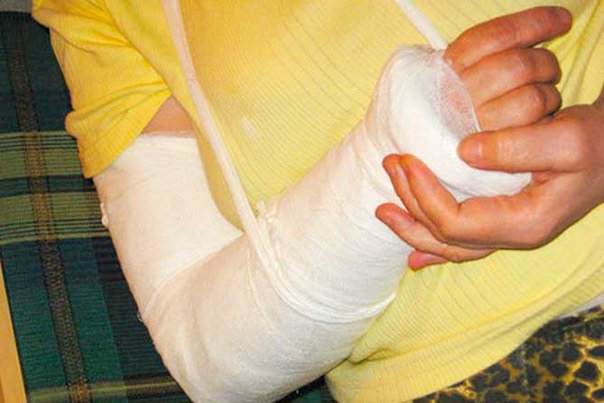 На Камчатке женщина сломала на гололеде руку и отсудила у чиновников 200 тыс рублей