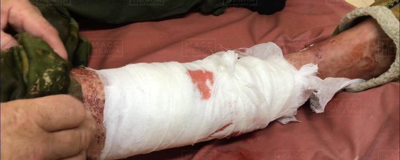 Медведица напала на жителя Камчатки